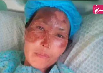 «در حال سوختن، تلاش می کردم از هوش نروم»