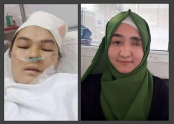 شاید برای کشتن ما به دانشگاه کابل بیایند